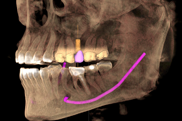 what-is-a-dental-cone-beam-ct-midtown-dental