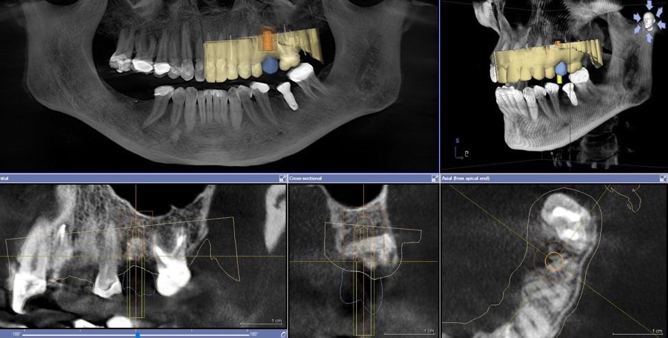 what-is-a-dental-cone-beam-ct-midtown-dental